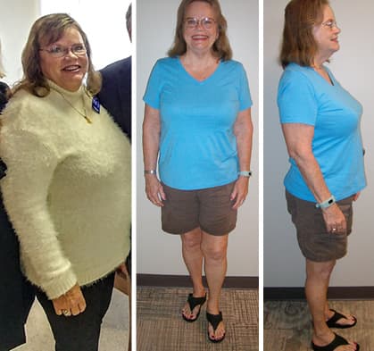 Sandra's Weight Loss
